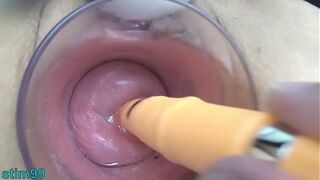 beautiful erotic Japanese hardcore MILF Cervix Fucking with German real penis dildo and asian chopsticks