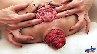 EXTREME PROLAPSE Pumping and Destroyed Pussy gorgeous mature MILF Sasha from ArgentinaNaked
